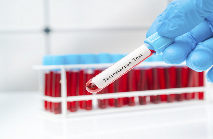 جو 24 : طبيب: قلة النوم تهدد صحة الرجال بوتيرة أسرع من التغيرات المرتبطة بالشيخوخة