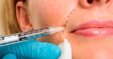 نص ملِ.. حكاية تريند تجميل أشعل السوشيال ميديا قبل العيد