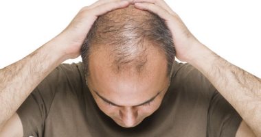 هل ارتداء القبعة "الكاب" لفترات طويلة يسبب الصلع؟