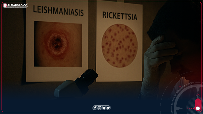 الإصحاح البيئي: اللشمانيا مرض مستوطن بالغرب والمؤشرات مطمئنة مع استمرار المكافحة