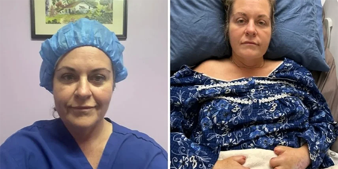عملية تجميل تتحول لكابوس مرعب.. أم تخضع لـ 20 عملية بتر