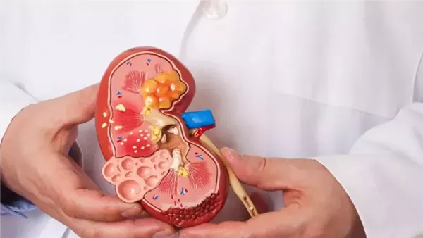 الصحة توجه نصائح للصيام الآمن لمرضى القلب والكلى في رمضان