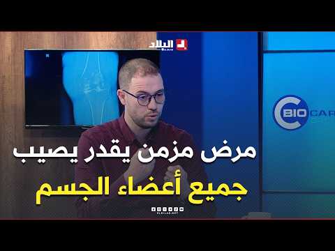 #بوالشحم_يعقوب.."التهاب المفاصل الروماتويدي المزمن يمكن أن يصيب كل أعضاء الجسم..منها أغشية القلب"