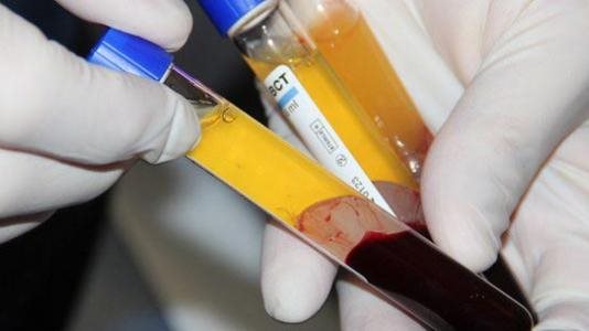 تعرّف على تشكيل مجلس مُراقبة عمليات الدم وتجميع البلازما واختصاصاته