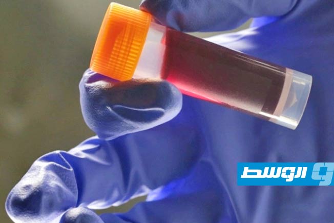 تحليل دم المعمرين يكشف عن 37 بروتينًا مرتبطة بإبطاء الشيخوخة