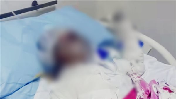 تفاصيل الساعات الأخيرة في حياة طفلة الشرقية بعد حروق مميتة
