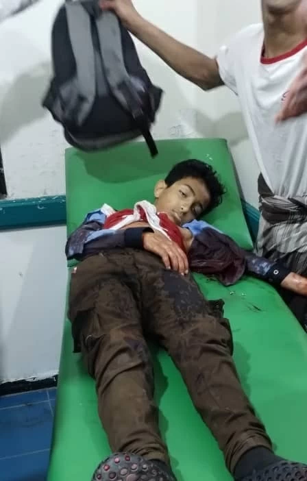 في جريمة حرب.. قناص حوثي يقتل طفلاً أمام شقيقته في تعز