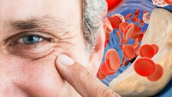 نوع ياميش غير متوقع يخفض الكوليسترول بالدم