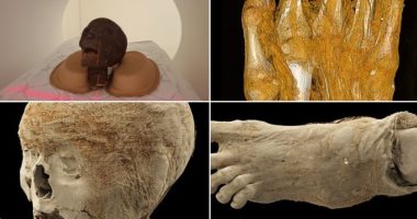 أسرار المومياوات.. كيف تكشف التحاليل الطبية حكايات عاشها القدماء؟