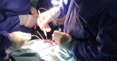 استخراج ملعقة من معدة فتاة 19 عامًا بمعهد الكبد فى المنوفية