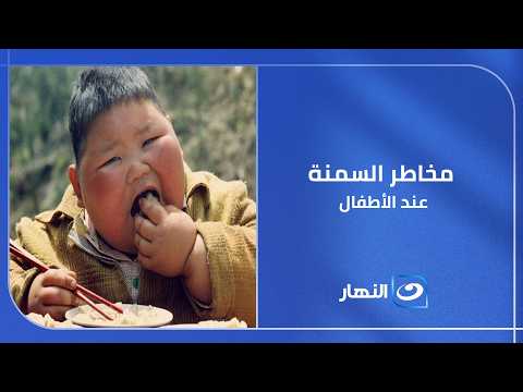 طفل عمره 8 سنوات ووزنه 95 كيلو!.. 😱 دكتور أسامة طه يكشف أخطر ما وصل إليه مرض السمنة عند الأطفال !!