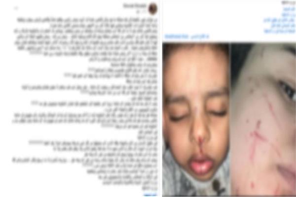 «أزمة الجيران».. حقيقة منشور الاعتداء على سيدة ونجلها بالغربية
