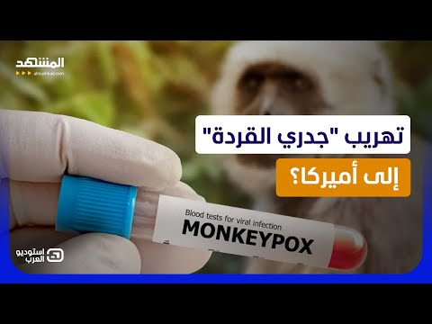 تهريب فيروس جدري القردة إلى الولايات المتحدة.. وصدمة في غرفة التحقيق!