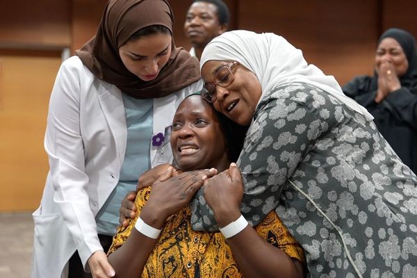 نجاح فصل التوأم الملتصق التنزاني «نانسي ونايس»