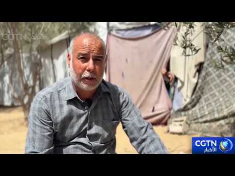 الأمراض الجلدية تفتك بأجساد النازحين في قطاع غزة
