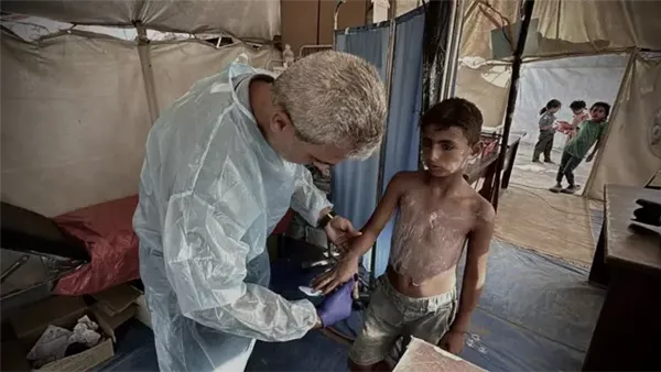 الفيروس تحول لتهديد حقيقي، زيادة أعداد الأطفال المصابين بجدري الماء في غزة