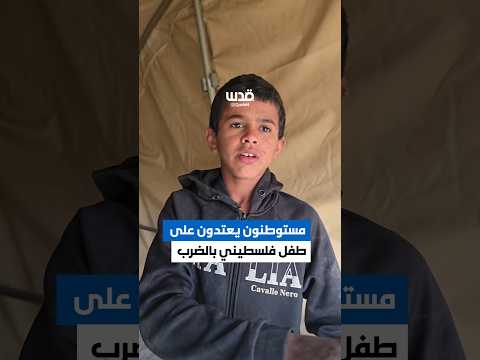 طفل يروي تفاصيل اعتداء مستوطنين عليه بالضرب المبرح قرب قرية تياسير، شرق طوباس.