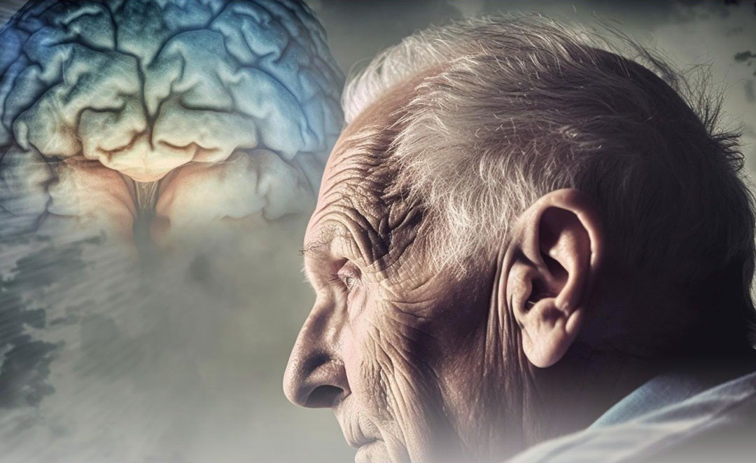 نقص الزنك يهدد حياة مرضى الخرف