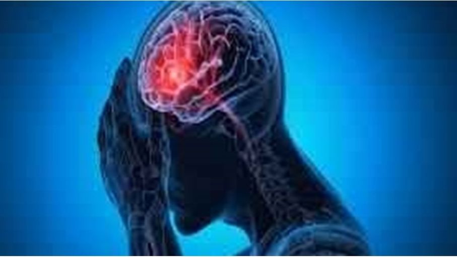 كيف تؤثر السكتة الدماغية على الذاكرة؟