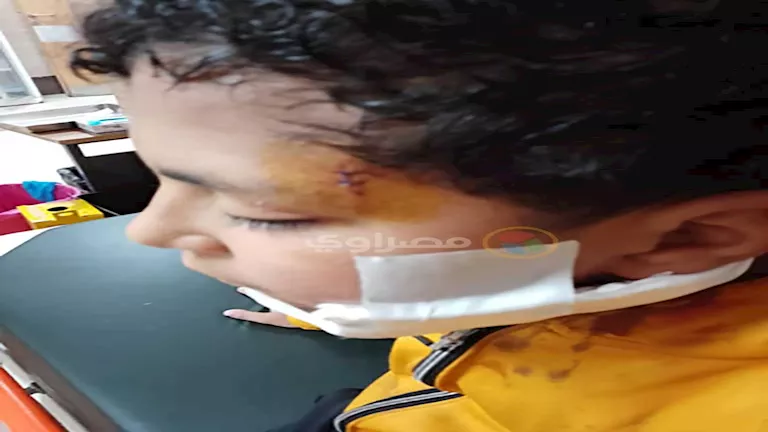 مأساة صلاة التراويح.. "طفل القلج" يشوه آخر بكتر داخل مسجد بالقلج