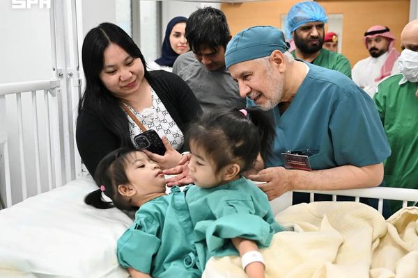 إنفاذًا لتوجيهات خادم الحرمين الشريفين وسمو ولي العهد.. بدء عملية فصل التوأم الملتصق الفلبيني (أوليفيا وجيانا)