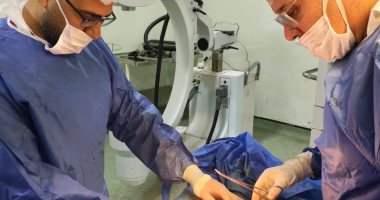 طاقم طبى بمستشفى دسوق العام يستخرج إبرة داخل ركبة طفل عمره 3 سنوات