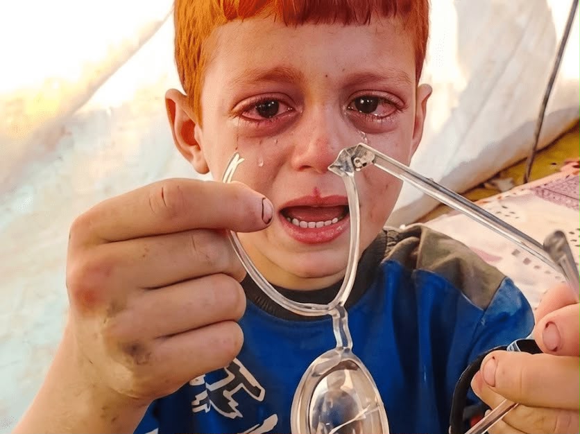 طواقم عملية "الفارس الشهم 3" تلبي نداء الطفل "أيوب "- فيديو