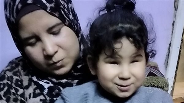 مأساة سجدة، ولدت بدون قرنية فى المنوفية وأسرتها تطلب التدخل لإنقاذها (فيديو)