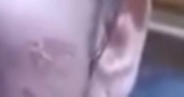 القبض على سيدة كوت ابنتها بشوكة ساخنة فى كفر الشيخ