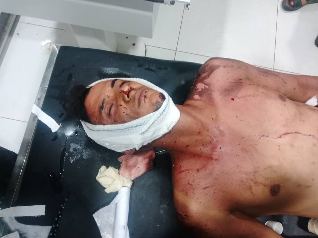 عاجل بالصور.. اكثر من 7 شهداء وعشرات الجرحى في انفجار مخزن سلاح بمعسكر للعمالقة الجنوبية بعدن
