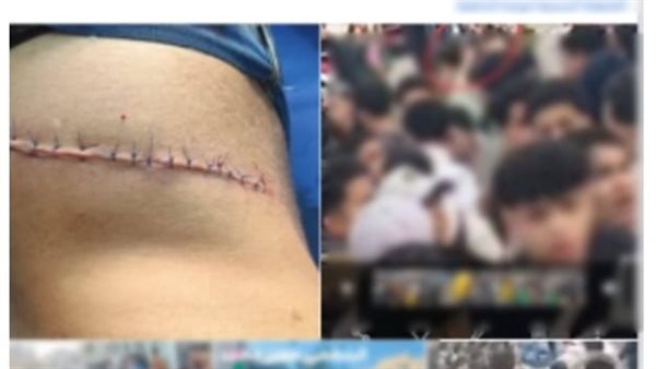الداخلية تكشف تفاصيل فيديو التعدي على طالب بـ"سلاح أبيض" أمام مدرسة بالمنوفية