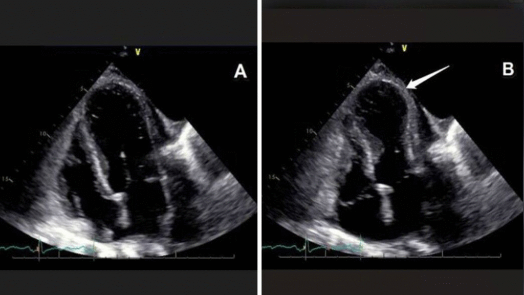 القلب يتأثر بالمشاعر: كيف يمكن للحب والحزن أن يؤثّرا فعليًا على صحة القلب؟ (ع.ع)