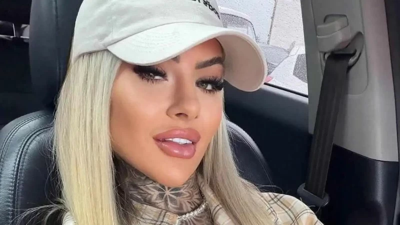 عملية تجميل تنهي حياة «نجمة إنستغرام»