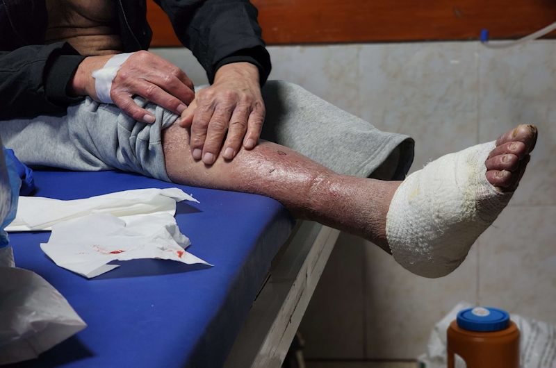 وسط إهمال طبي.. الجرب يتفشى بين أسرى فلسطينيين في سجن إسرائيلي