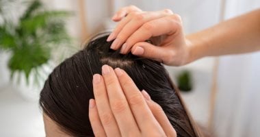 أعراض الإصابة بأكزيما فروة الرأس..وطرق فعالة للعلاج