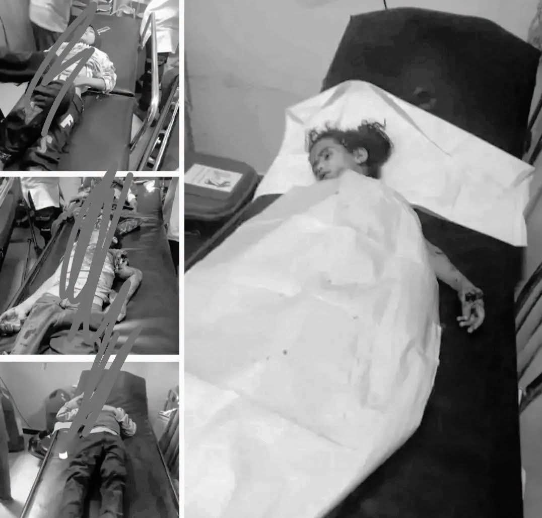 عاجل .. فاجعة مروعة تهز الضالع.. سقوط أطفال بين شهيد وجريح بانفجار من مخلفات الحوثي
