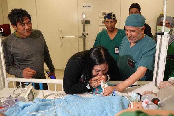 في إنجاز طبي جديد.. نجاح عملية فصل التوأم الملتصق الفلبيني (أوليفيا وجيانا) بعد 6 ساعات