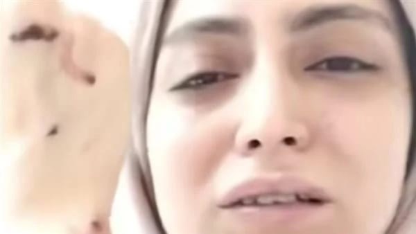 أول تعليق من طبيبة الأسنان بعد الاعتداء عليها داخل أحد المراكز بشبرا الخيمة
