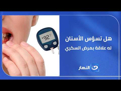 هل تسوّس الأسنان له علاقة بمرض السكري؟#الستات #النهار