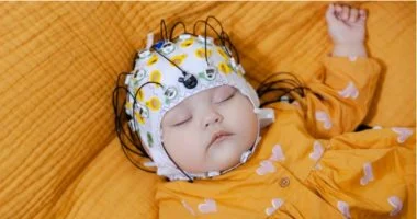 دراسة بريطانية تكشف ارتباطاً بين اضطرابات نوم الرضع وزيادة احتمالية الإصابة بالتوحد