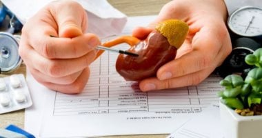 حصوات الكلى.. إجابات أهم 5 أسئلة عن الأعراض والمضاعفات