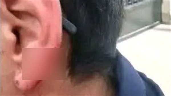 طالب يعض زميله ويقطع أذنه بمدرسة في الإسكندرية، والمديرية تعاقبه بالفصل أسبوعين