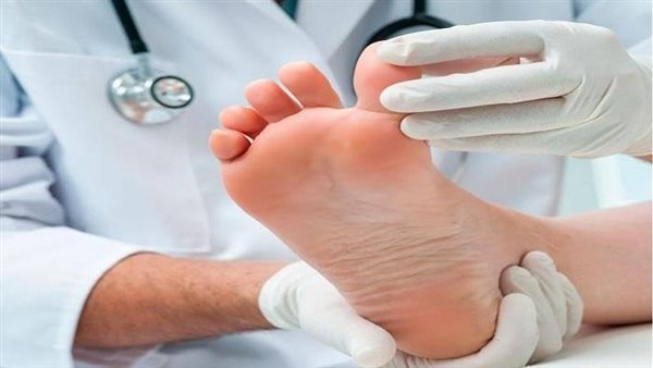 الصحة تحذر مرضى السكري: انتبهوا هذه العلامات تتسبب في بتر القدمين