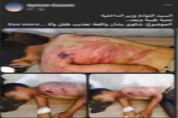 ضبط شخصين لاتهامهما بتعذيب طفل وإصابته في المنوفية