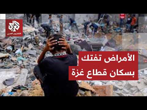 آلاف الإصابات بجدري الماء في قطاع غزة وعجز الأونروا يهدد حياة الفلسطينيين