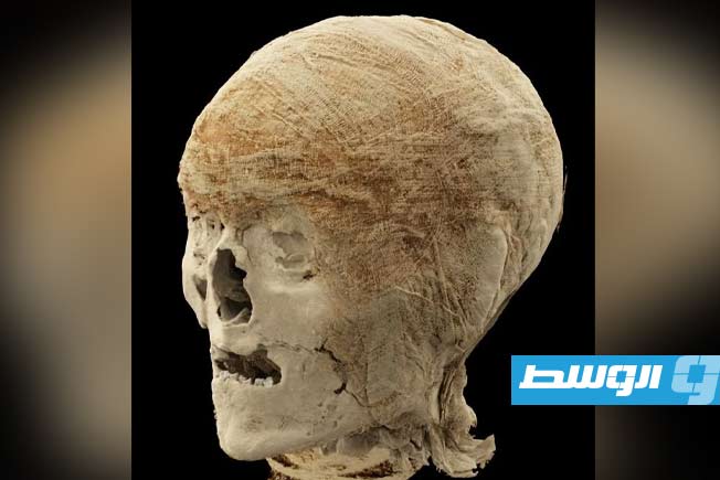 «دون إتلاف خيط واحد».. الأشعة المقطعية تكشف أسرار التاريخ الصحي للمصريين القدماء