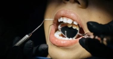 حالة تصيب أسنان ملايين الأطفال تتسبب فى ضعفها وتسوسها.. ما هي وكيف تحدث؟
