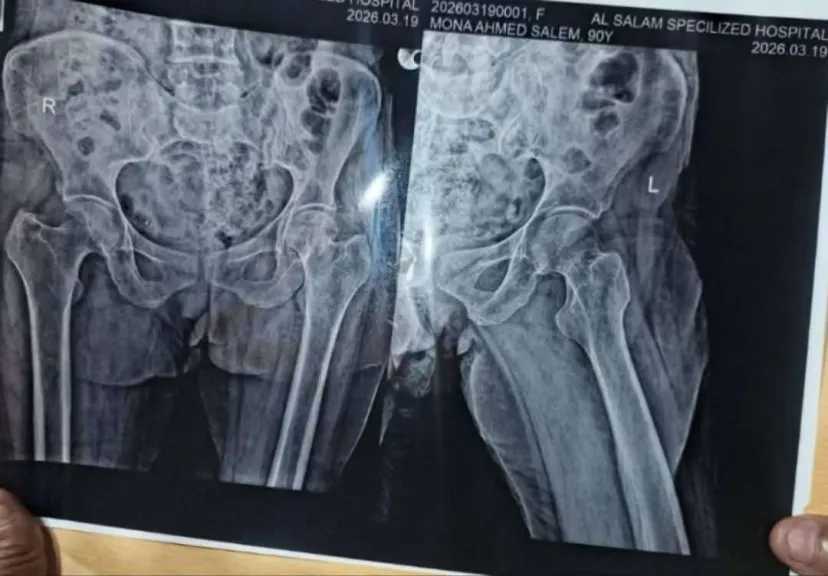 سعر كرسي متحرك حوّل حياة جدة إلى جحيم! 105 ألف ريال بينها وبين الحياة