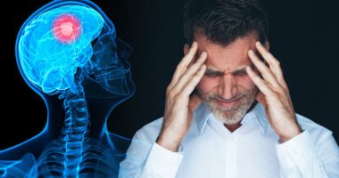 5 عوامل تشير إلى احتمالية الإصابة بالسكتة الدماغية بعد الشفاء