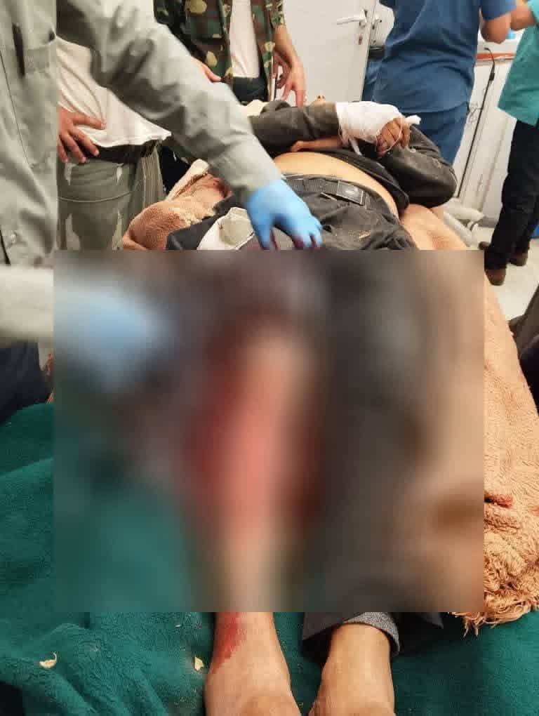 مقتل مسن برصاص قنّاص حوثي في تعز